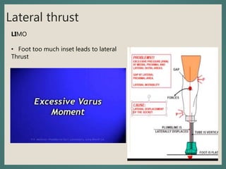 Lateral thrust
LIMO
• Foot too much inset leads to lateral
Thrust
 