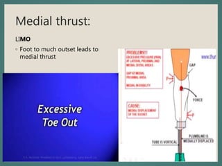Medial thrust:
LIMO
◦ Foot to much outset leads to
medial thrust
 