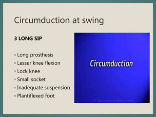 Circumduction at swing
3 LONG SIP
◦ Long prosthesis
◦ Lesser knee flexion
◦ Lock knee
◦ Small socket
◦ Inadequate suspension
◦ Plantiflexed foot
 