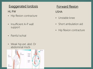 Forward flexion
Exaggerated lordosis
HI, PW
• Hip flexion contracture
• Insufficient A-P wall
support
• Painful ischial
• Weak hip ext. abd. Or
abdominal mscls
USHA
• Unstable knee
• Short ambulation aid
• Hip flexion contracture
 