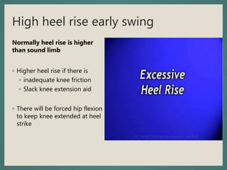 High heel rise early swing
Normally heel rise is higher
than sound limb
◦ Higher heel rise if there is
◦ inadequate knee friction
◦ Slack knee extension aid
◦ There will be forced hip flexion
to keep knee extended at heel
strike
 