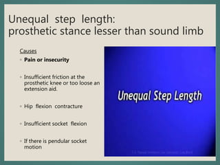 Unequal step length:
prosthetic stance lesser than sound limb
Causes
◦ Pain or insecurity
◦ Insufficient friction at the
prosthetic knee or too loose an
extension aid.
◦ Hip flexion contracture
◦ Insufficient socket flexion
◦ If there is pendular socket
motion
 
