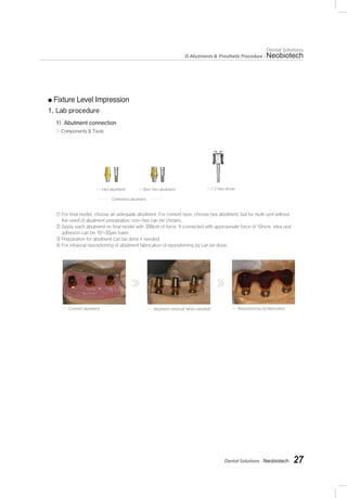 Dental Solutions - Neobiotech 27
Dental Solutions
IS Abutments & Prosthetic Procedure - Neobiotech
Fixture Level Impression
 
