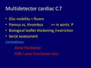 Multidetector cardiac C.T
• Disc mobility = fluoro
• Pannus vs. thrombus ++ in aortic P
• Biological leaflet thickening /restriction
• Serial assessment
Limitations
Atrial fibrillation
SOB / poor functional class
 