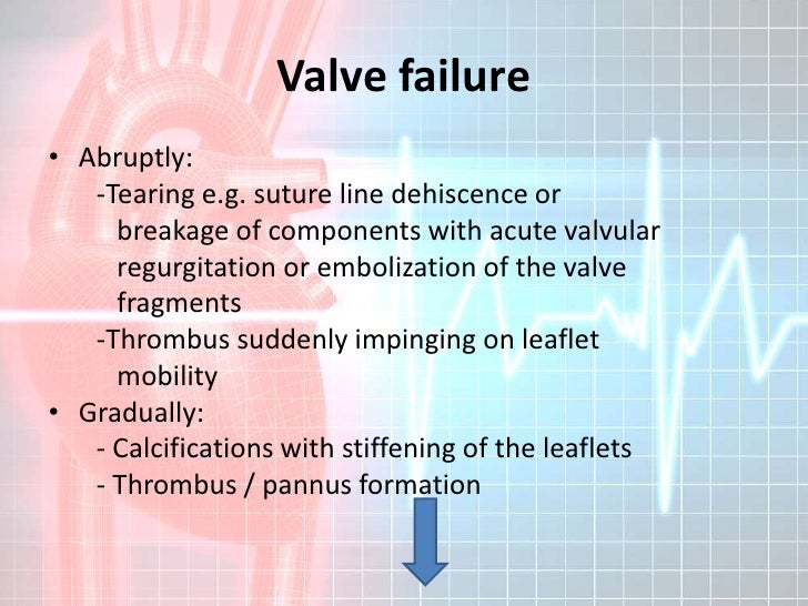 Prosthetic Heart Valves