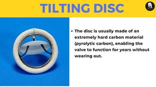 TILTING DISC
The disc is usually made of an
extremely hard carbon material
(pyrolytic carbon), enabling the
valve to function for years without
wearing out.
 