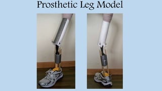 Prosthetic Leg Model
 