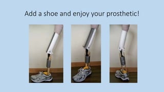 Add a shoe and enjoy your prosthetic!
 
