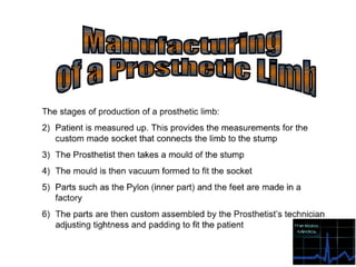 Prosthetic limbs final