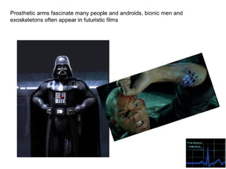 Prosthetic limbs final