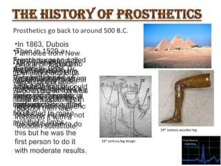 Prosthetic limbs final
