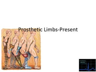 Prosthetic limbs final