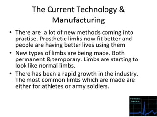 Prosthetic limbs final