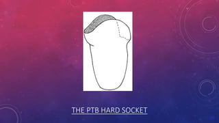 THE PTB HARD SOCKET
 