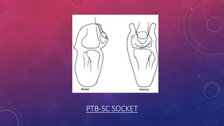 PTB-SC SOCKET
 