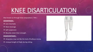 KNEE DISARTICULATION
Also known as through knee amputation ( TKA )
ADVANTAGES :
 Less traumatic
 More leverage
 Self suspension
 Muscles retain their strength.
DISADVANTAGES :
 Amputees may not like the look of bulbous stump.
 Unequal length of thigh during sitting.
 