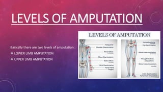 LEVELS OF AMPUTATION
Basically there are two levels of amputation :
 LOWER LIMB AMPUTATION
 UPPER LIMB AMPUTATION
 