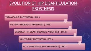 EVOLUTION OF HIP DISARTICULATION
PROSTHESIS
TILTING TABLE PROSTHESIS ( 1940 )
U.S. NAVY HYDRAULIC PROSTHESIS ( 1945 )
CANADIAN HIP DISARTICULATION PROSTHESIS ( 1954 )
SAUCER-TYPE PROSTHESIS ( 1957 )
UCLA ANATOMICAL H.D. PROSTHESIS ( 1980 )
 