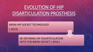 EVOLUTION OF HIP
DISARTICULATION PROSTHESIS
BIKINI HIP SOCKET TECHNOLOGY
( 2013)
RE-DEFINING HIP DISARTICULATION
WITH THE BIKINI SOCKET ( 2016 )
 
