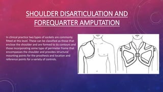 SHOULDER DISARTICULATION AND
FOREQUARTER AMPUTATION
In clinical practice two types of sockets are commonly
fitted at this level. These can be classified as those that
enclose the shoulder and are formed to its contours and
those incorporating some type of perimeter frame that
encompasses the shoulder and provides structural
mounting points for the prosthesis and location and
reference points for a variety of controls.
 