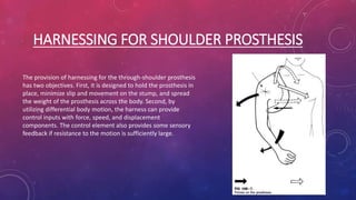 HARNESSING FOR SHOULDER PROSTHESIS
The provision of harnessing for the through-shoulder prosthesis
has two objectives. First, it is designed to hold the prosthesis in
place, minimize slip and movement on the stump, and spread
the weight of the prosthesis across the body. Second, by
utilizing differential body motion, the harness can provide
control inputs with force, speed, and displacement
components. The control element also provides some sensory
feedback if resistance to the motion is sufficiently large.
 