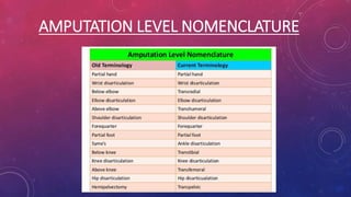AMPUTATION LEVEL NOMENCLATURE
 
