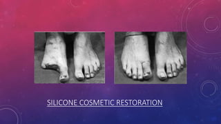SILICONE COSMETIC RESTORATION
 