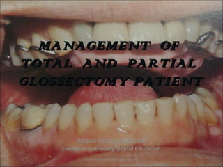 MANAGEMENT OFMANAGEMENT OF
TOTAL AND PARTIALTOTAL AND PARTIAL
GLOSSECTOMY PATIENTGLOSSECTOMY PATIENT
INDIAN DENTAL ACADEMY
Leader in continuing Dental Education
www.indiandentalacademy.com
 