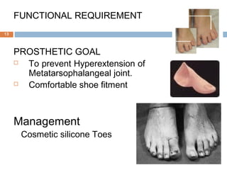 FUNCTIONAL REQUIREMENT
PROSTHETIC GOAL
 To prevent Hyperextension of
Metatarsophalangeal joint.
 Comfortable shoe fitment
Management
Cosmetic silicone Toes
13
 