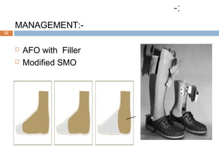 :-
MANAGEMENT:-
 AFO with Filler
 Modified SMO
32
 
