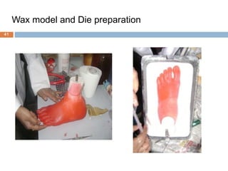 Wax model and Die preparation
41
 