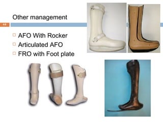 Other management
 AFO With Rocker
 Articulated AFO
 FRO with Foot plate
44
 