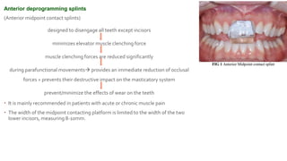 Prosthetic management of tmd | PPTX