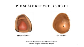 Ptb Socket Design PROSTHETIC MANAGEMENT OF TRANSTIBIAL AMPUTATION AND ITS BIOMECHANICS | PDF