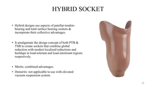Ptb Socket Design PROSTHETIC MANAGEMENT OF TRANSTIBIAL AMPUTATION AND ITS BIOMECHANICS | PDF