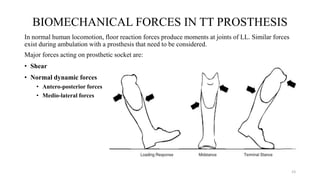 PROSTHETIC MANAGEMENT OF TRANSTIBIAL AMPUTATION AND ITS BIOMECHANICS | PDF