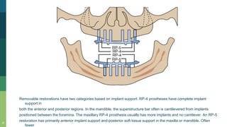Removable restorations have two categories based on implant support. RP-4 prostheses have complete implant
support in
both the anterior and posterior regions. In the mandible, the superstructure bar often is cantilevered from implants
positioned between the foramina. The maxillary RP-4 prosthesis usually has more implants and no cantilever. An RP-5
restoration has primarily anterior implant support and posterior soft tissue support in the maxilla or mandible. Often
fewer
15
 