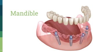 17
Mandible
 