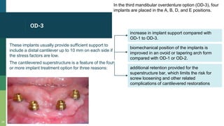 OD-3
These implants usually provide sufficient support to
include a distal cantilever up to 10 mm on each side if
the stress factors are low.
The cantilevered superstructure is a feature of the four
or more implant treatment option for three reasons:
24
In the third mandibular overdenture option (OD-3), four
implants are placed in the A, B, D, and E positions.
increase in implant support compared with
OD-1 to OD-3.
biomechanical position of the implants is
improved in an ovoid or tapering arch form
compared with OD-1 or OD-2.
additional retention provided for the
superstructure bar, which limits the risk for
screw loosening and other related
complications of cantilevered restorations
 