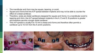 28
• The mandibular arch form may be square, tapering, or ovoid.
• Square arch forms limit the A-P spread between implants and may not be able to counter the
effect of a distal cantilever.
• Therefore, rarely are distal cantilevers designed for square arch forms. In a mandibular ovoid to
tapering arch form, the A-P spread between implants in the A, E and D, B positions is greater
and therefore permits a longer distal cantilever.
• This A-P spread is usually 8 to 10 mm in these arch forms and therefore often permits a
cantilever up to 10 mm from the A and E positions.
 
