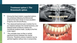 Treatment option 1: The
Branemark option
▪ Among the fixed implant–supported options,
the prosthesis following the Brånemark
protocol has been shown to have excellent
longevity and clinical efficacy.
▪ This classical treatment plan involves four to
six implants between the mental foramina, and
bilateral distal cantilevers replace the
mandibular posterior teeth, usually to the first
molar region.
▪ The mandible does not flex or exhibit
significant torsion between the mental
foramina. Therefore anterior implants may be
splinted together without risk or compromise.
30
 