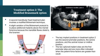 Treatment option 2: The
Modified Branemark option
▪ A second mandibular fixed treatment plan
involves a modified Brånemark technique.
▪ A slight variation of the Brånemark protocol is
to place additional implants above the mental
foramina because the mandible flexes distal to
the foramen.
33
• The key implant positions in treatment option 2
are the second premolar positions, the canine
positions, and the central incisor or midline
position.
• The two optional implant sites are the first
premolar sites and are more often indicated
when the patient force factors are greater than
usual.
 