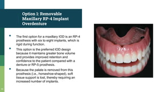 Option 1: Removable
Maxillary RP-4 Implant
Overdenture
▪ The first option for a maxillary IOD is an RP-4
prosthesis with six to eight implants, which is
rigid during function.
▪ This option is the preferred IOD design
because it maintains greater bone volume
and provides improved retention and
confidence to the patient compared with a
denture or RP-5 prosthesis.
▪ Because the palate is removed from this
prosthesis (i.e., horseshoe-shaped), soft
tissue support is lost, thereby requiring an
increased number of implants.
43
 