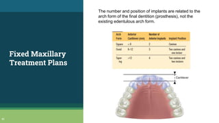 Fixed Maxillary
Treatment Plans
46
The number and position of implants are related to the
arch form of the final dentition (prosthesis), not the
existing edentulous arch form.
 