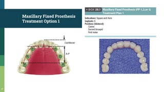 Maxillary Fixed Prosthesis
Treatment Option 1
47
 