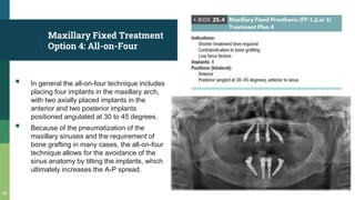 Maxillary Fixed Treatment
Option 4: All-on-Four
▪ In general the all-on-four technique includes
placing four implants in the maxillary arch,
with two axially placed implants in the
anterior and two posterior implants
positioned angulated at 30 to 45 degrees.
▪ Because of the pneumatization of the
maxillary sinuses and the requirement of
bone grafting in many cases, the all-on-four
technique allows for the avoidance of the
sinus anatomy by tilting the implants, which
ultimately increases the A-P spread.
50
 