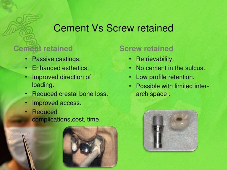 Prosthetic options in implant dentistry