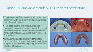 Maxillary Rp Comprehensive Prosthetic Options in Implant Dentistry for Edentulous ...