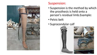Suspension:
• Suspension is the method by which
the prosthesis is held onto a
person’s residual limb.Example:
• Pelvic belt
• Supracondylar calf
 