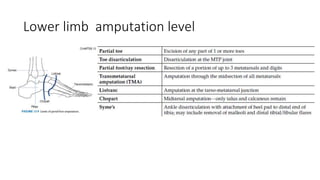 Lower limb amputation level
 